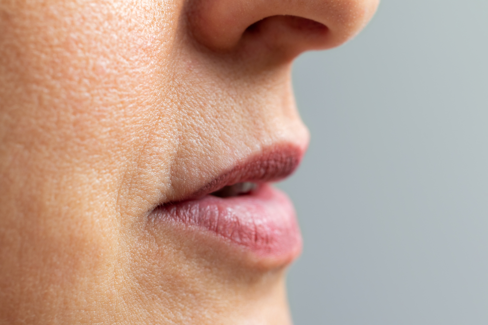 juvederm around mouth